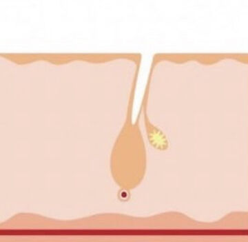 IMG_6553